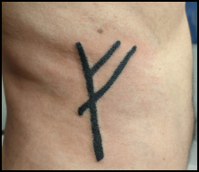 Photo du projet Rune (Hand poke)