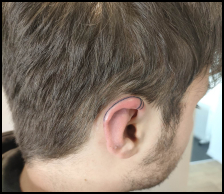 Photo du projet Hand poke oreille